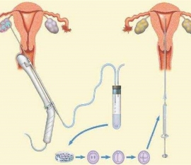 35岁女性备孕请做好以下检查，“健康金华代生宝宝”跑不远